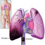 computed-tomography-2