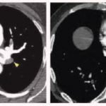 computed-tomography-22