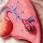 computed-tomography-3