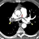 computed-tomography-4