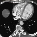 computed-tomography-5