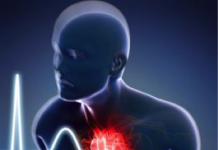 Sudden Cardiac Death; Echocardiography as a Diagnostic Tool. (Part II) by Olayinka Adeoye ECHOCARDIOGRAPHY with Adeoye