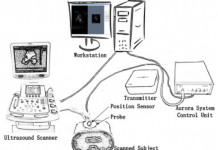 FREEHAND THREE DIMENSIONAL ULTRASOUND (US) IMAGING SYSTEM IN THE ASSESSMENT OF SCOLIOSIS FREEHAND THREE DIMENSIONAL ULTRASOUND (US) IMAGING SYSTEM IN THE ASSESSMENT OF SCOLIOSIS