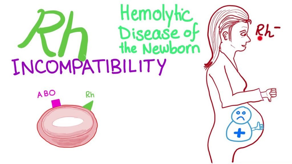 research work on rhesus incompatibility